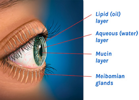 Dry Eye Syndrome